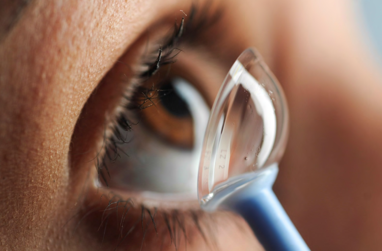 Specialty contact lens, Scleral lens or Scleral Contacts.