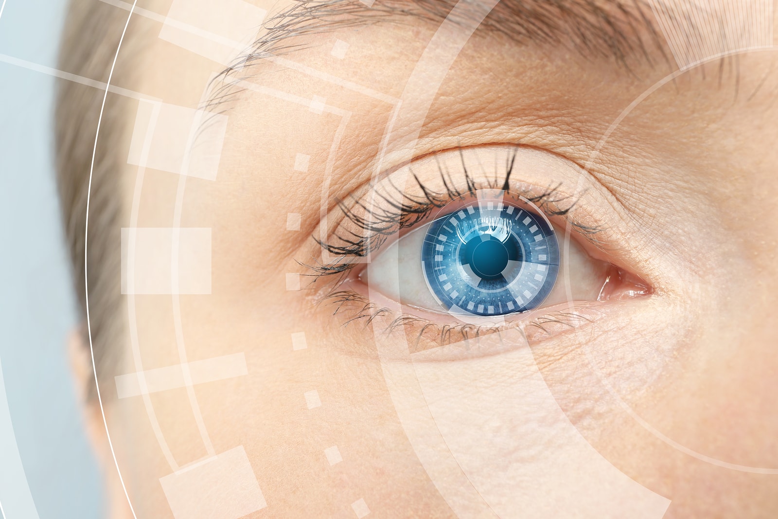 multifocal contacts-contact exam