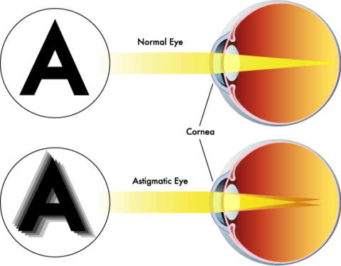 Eye Exams | Nearsighted, Farsighted & Astigmatism Treatment